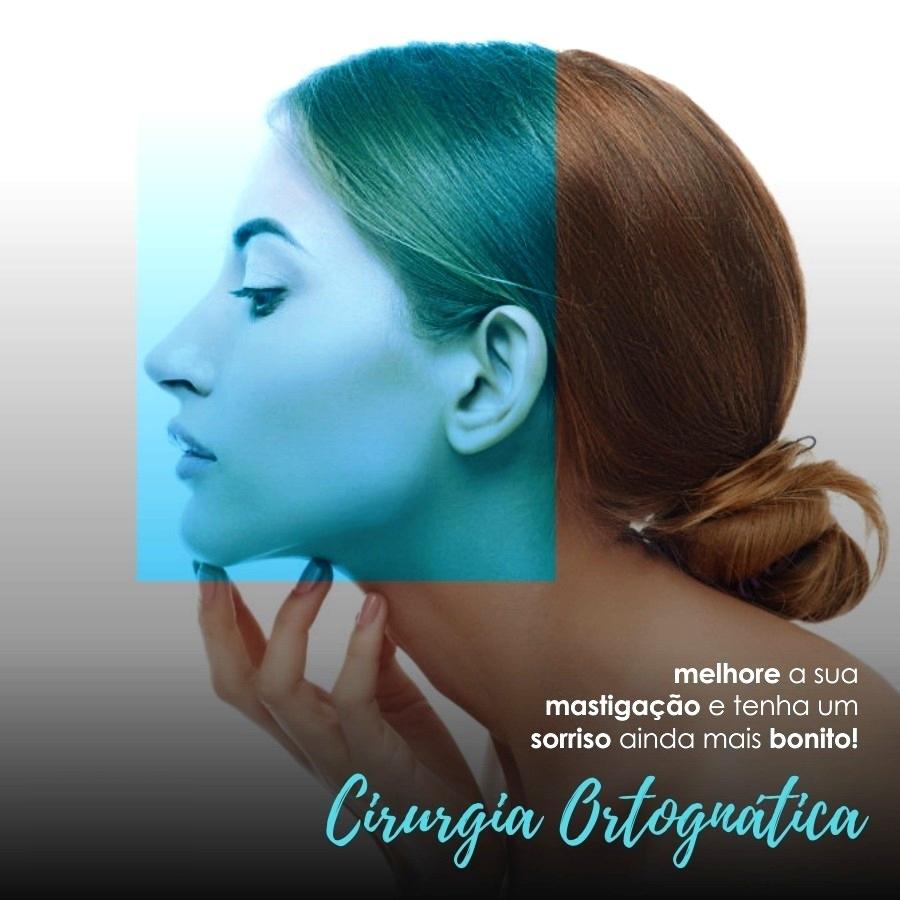 PROGNATIA, RETROGNATIA, MORDIDA ABERTA, ATRESIAS DOS ARCOS, DEFORMIDADES DENTOFACIAIS SÃO TRATADAS AQUI!!! Filosofia CIROOH Odontologia - Estética e Funcional
